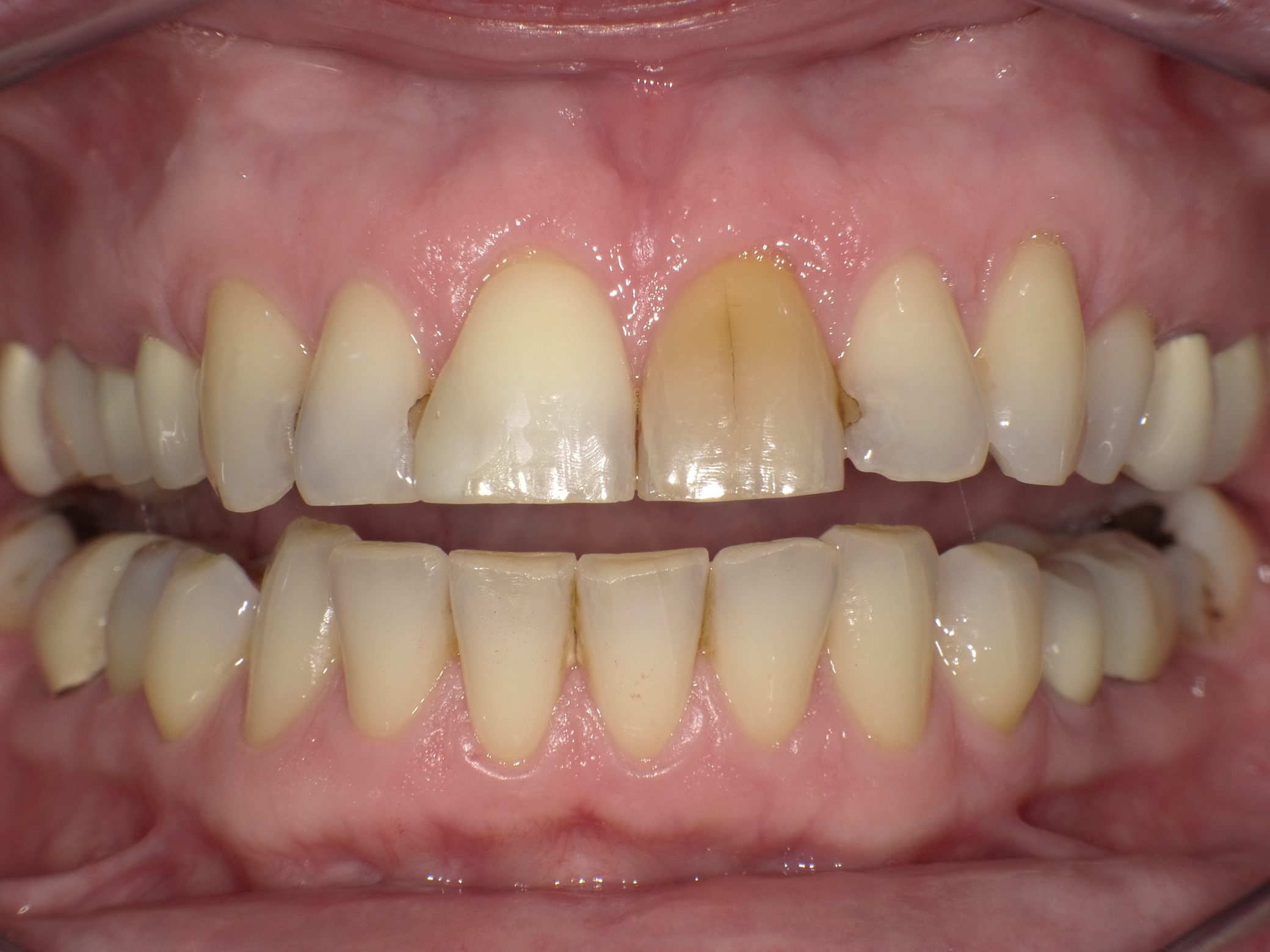 Patientin mit dem Wunsch nach ästhetischer Optimierung